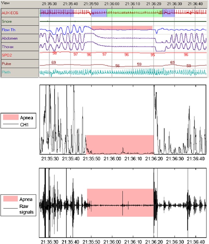 Figure 2