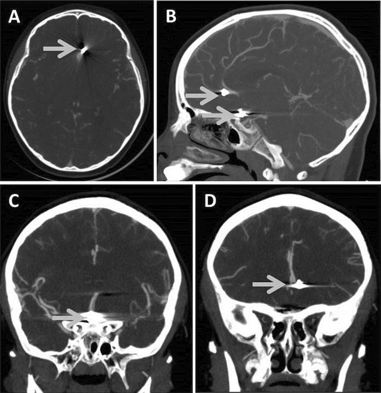 Fig. 1