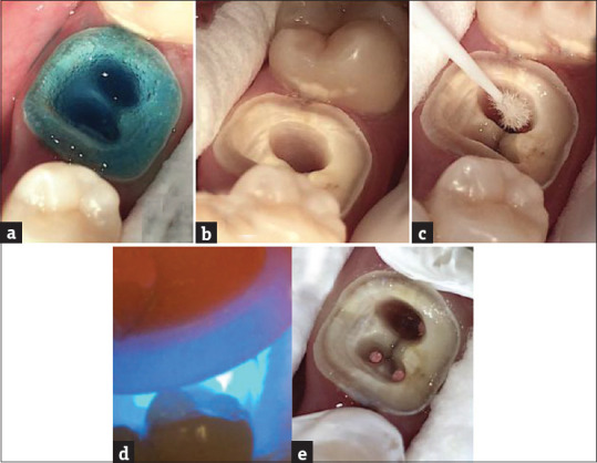 Figure 10