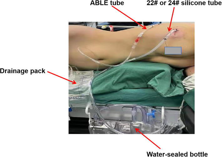 FIGURE 4