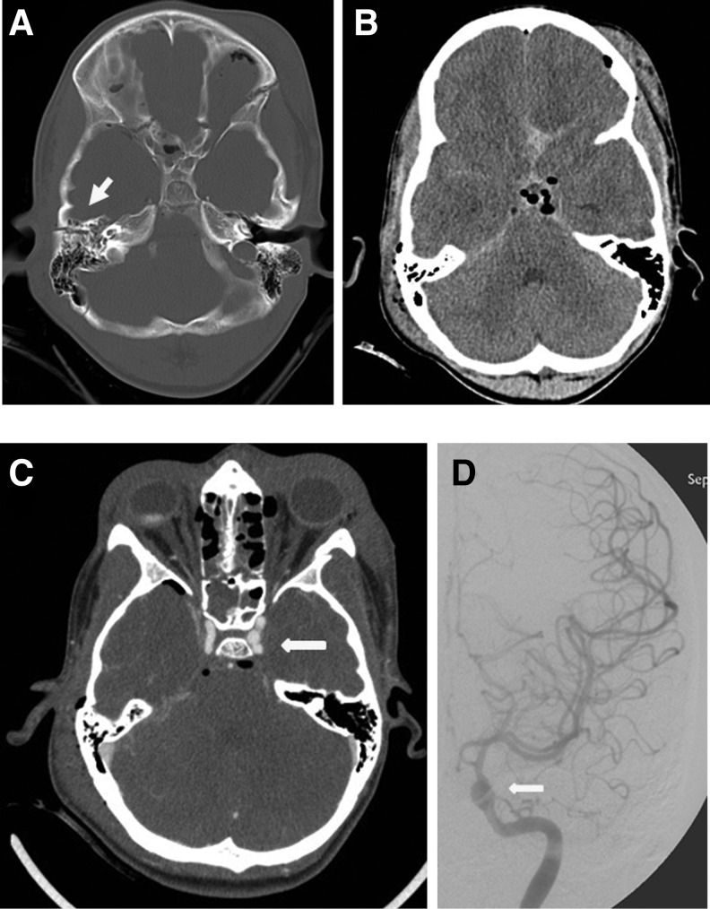 FIG. 2.