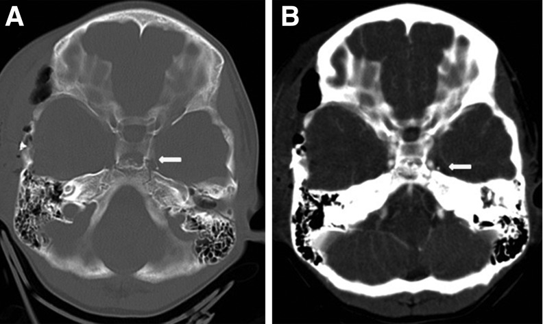 FIG. 3.