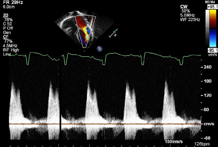 Figure 2