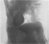 314-1
