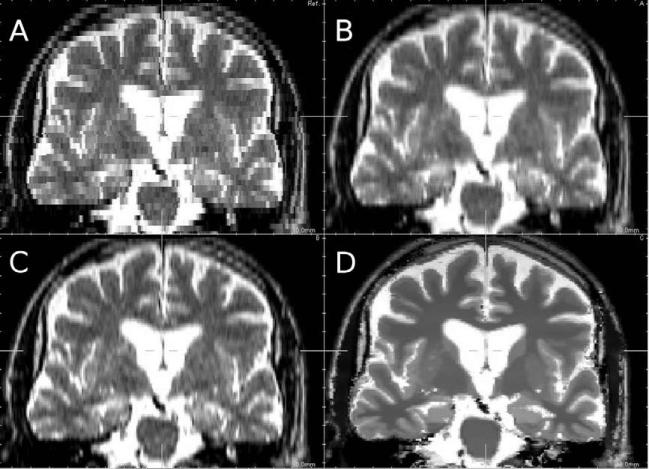 Fig. 16