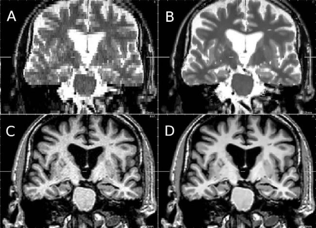 Fig. 18