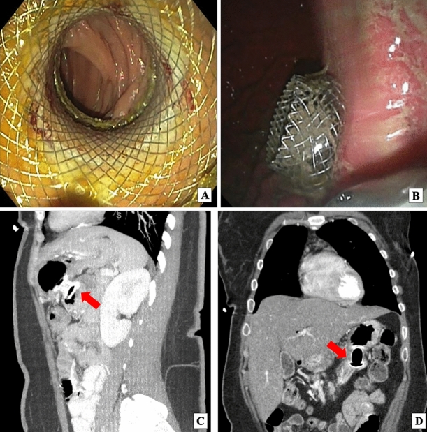 Fig. 4