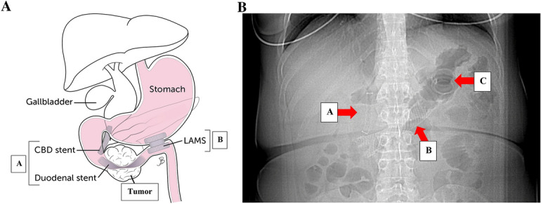 Fig. 5