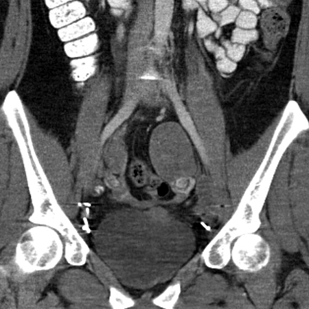 Fig. 1d.