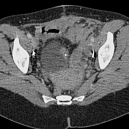 Fig. 1c.