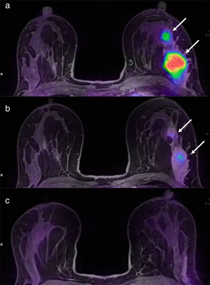 FIGURE 15