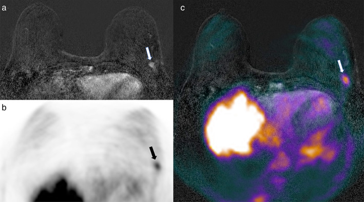 FIGURE 3