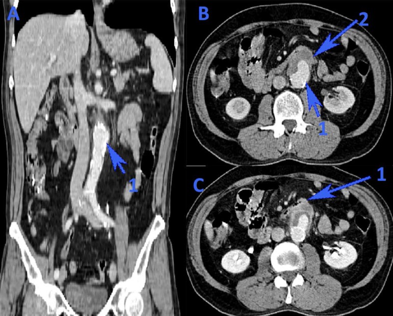 Fig. 1