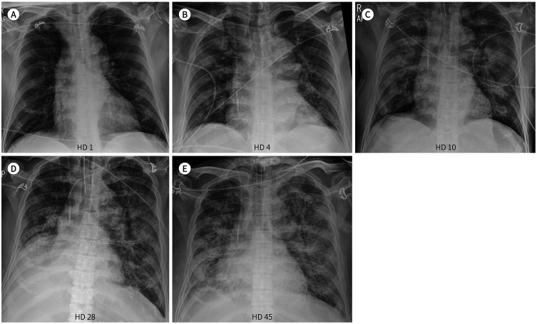 Fig. 3