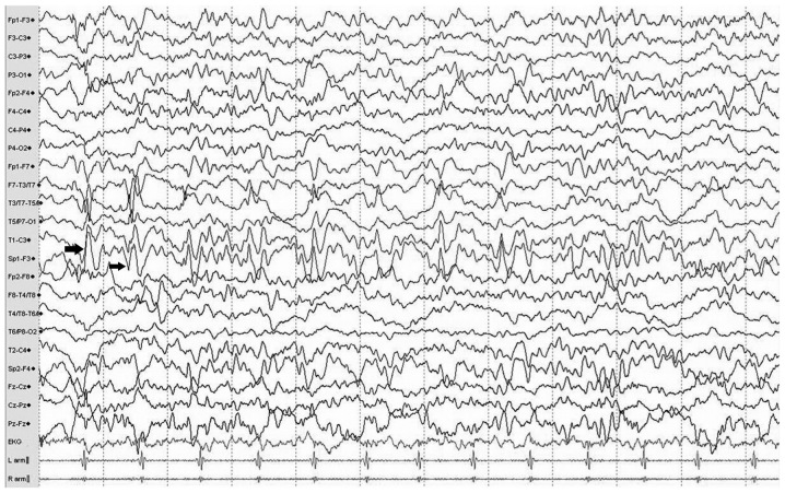 Figure 2.