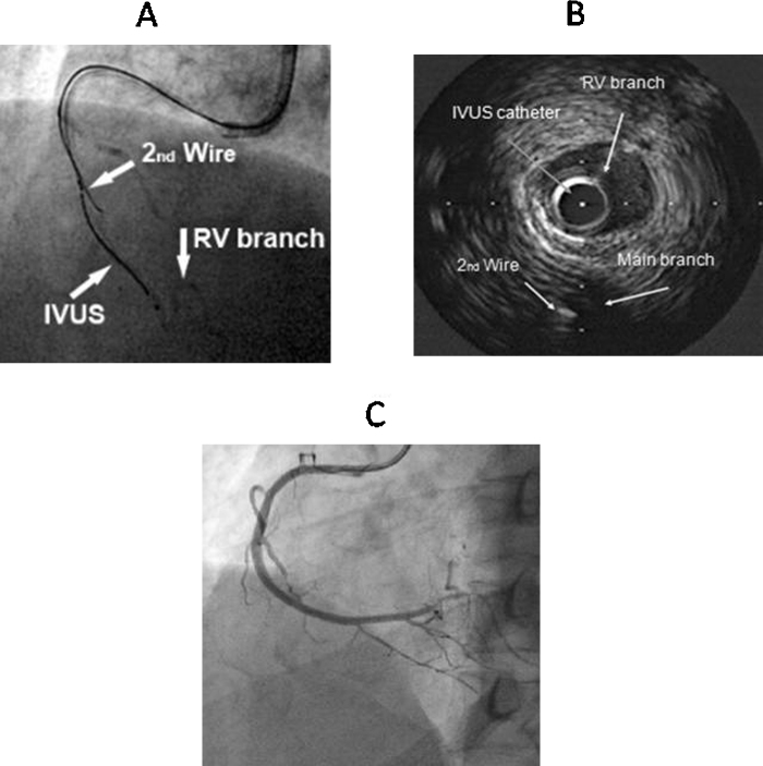 Fig. 4