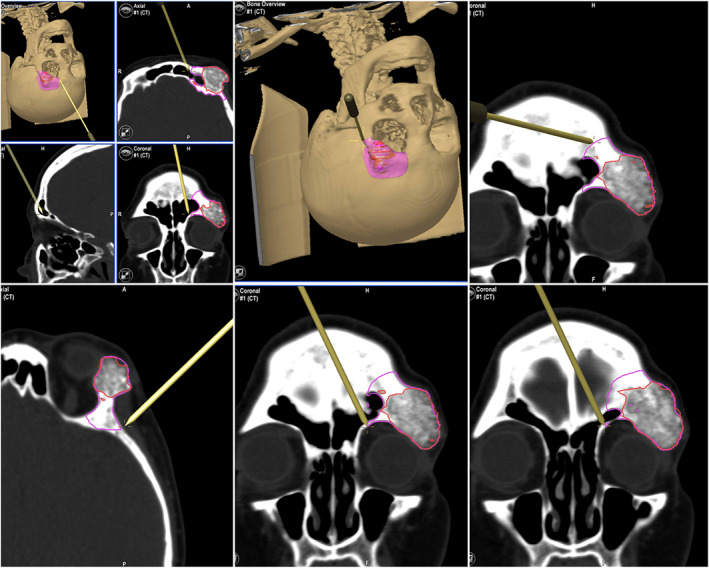 FIGURE 4