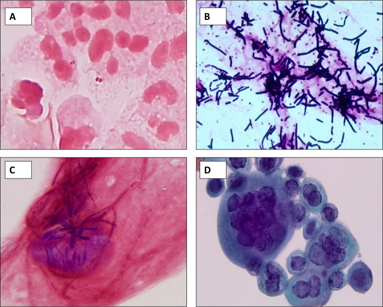 FIG 2