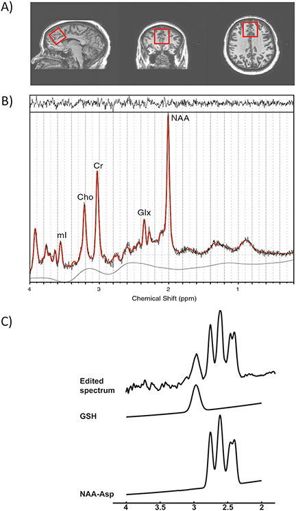 Fig. 1