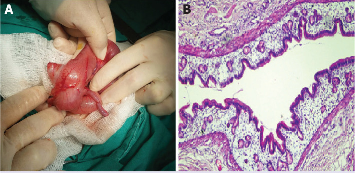 FIGURE 2