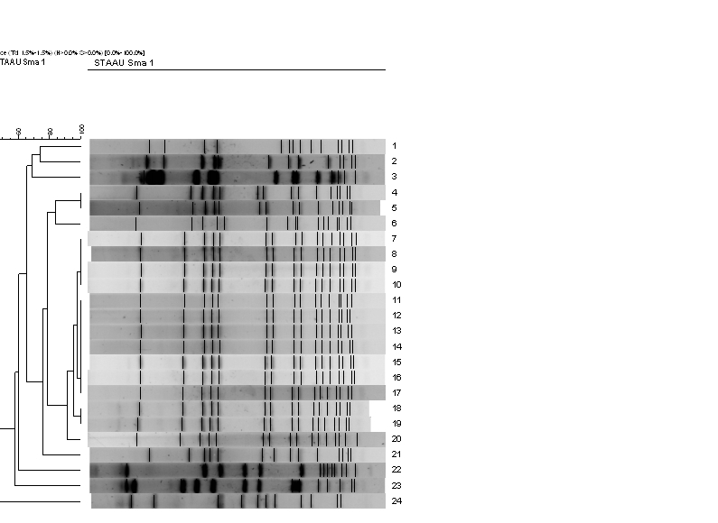 Banding patterns determined by pulsed-field electrophoresis (PFGE) and dendrogram showing the genetic relatedness of 24 MSSA isolates recovered from inmates of the Nantes prison, France, in 2008-2011 (numbers 1 to 6 and 21 to 24: PVL-negative MSSA non-epidemic strains; numbers 7 to 20: PVL-positive MSSA epidemic strain).