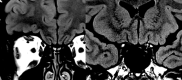 Fig 7
