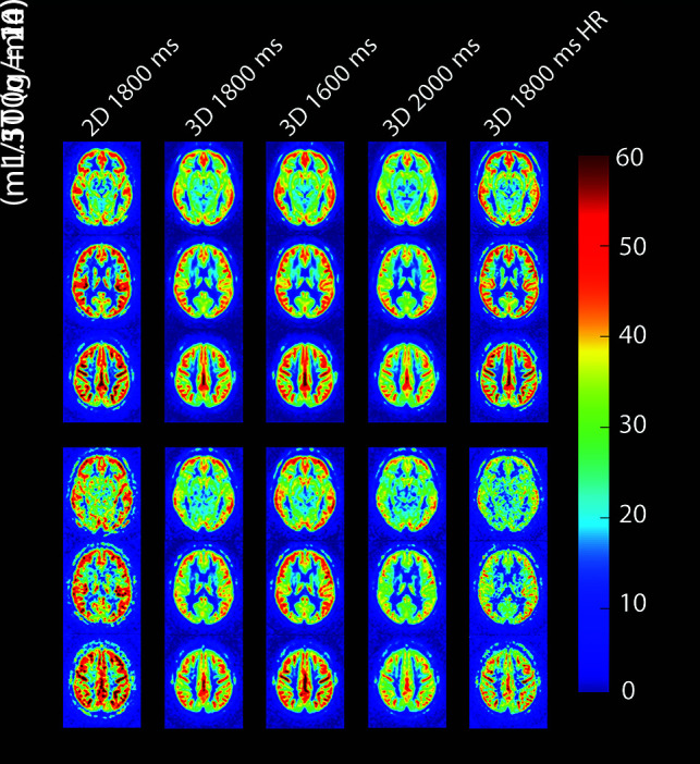 FIG 2.