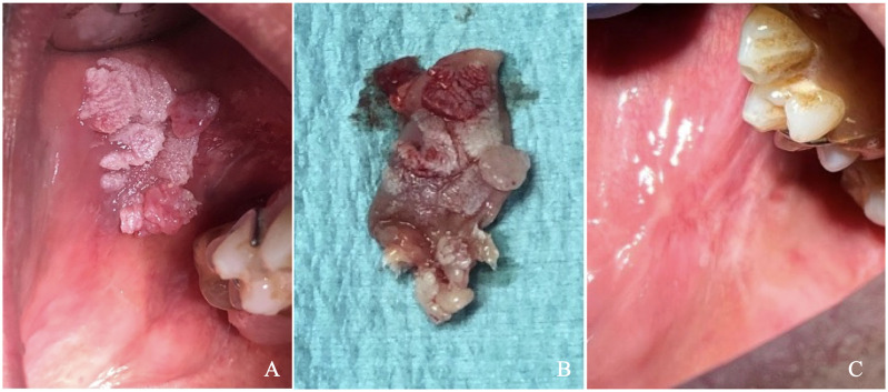 Figure 1