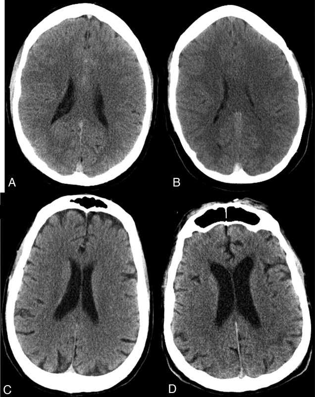 Fig 3.