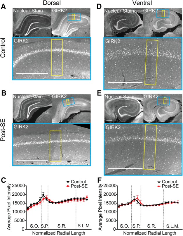 Figure 11.