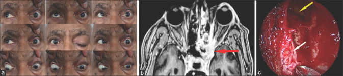 Figure 14