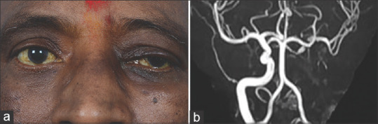 Figure 16