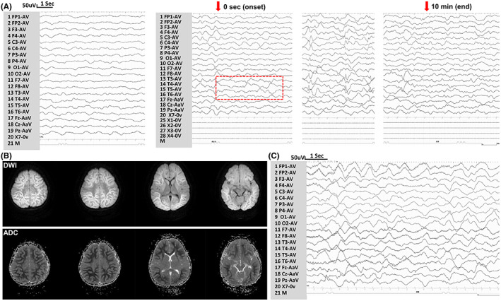 FIGURE 2