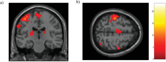 Fig. 10.