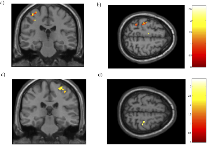 Fig. 12.