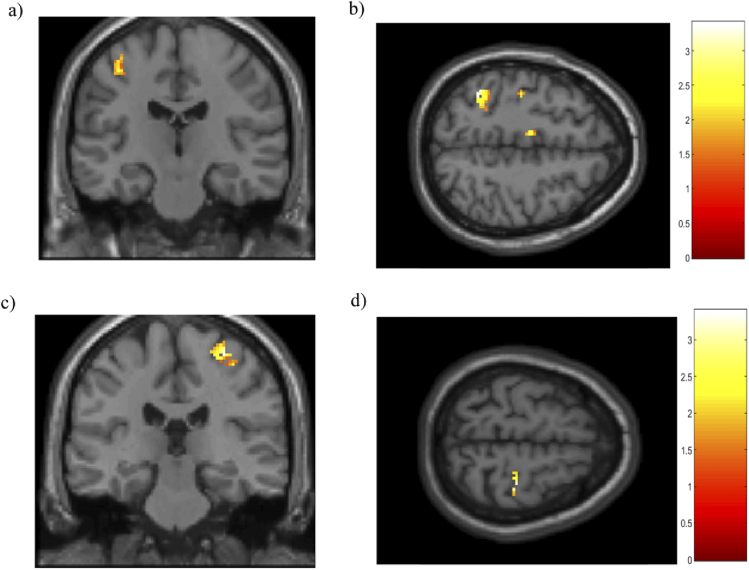 Fig. 11.