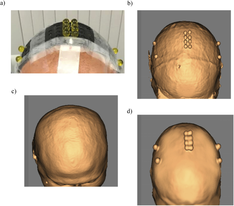 Fig. 4.