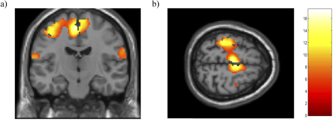 Fig. 13.