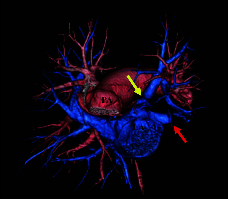 Fig. 3