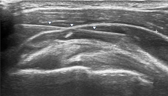Fig. 4