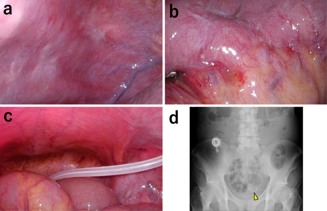 Figure 5.