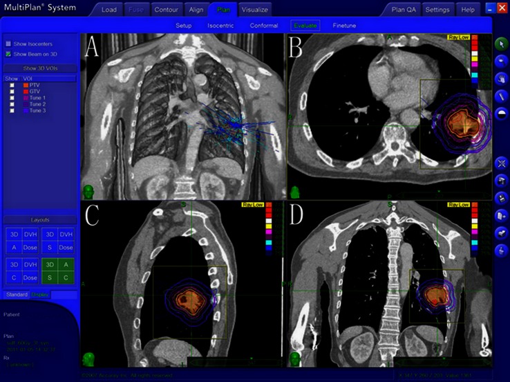 Fig. 1