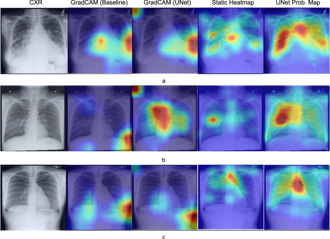 Fig. 17