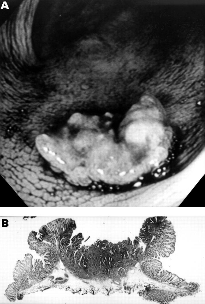 Figure 1  