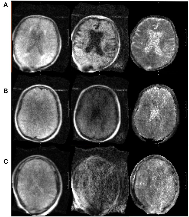 Figure 9