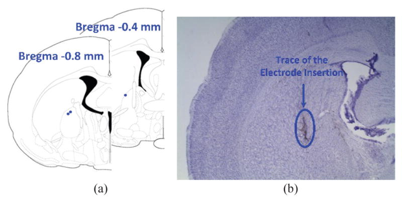 Fig. 14