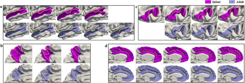 Fig. 14.