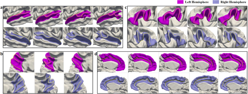 Fig. 13.