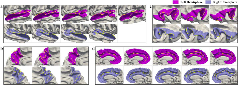 Fig. 15.