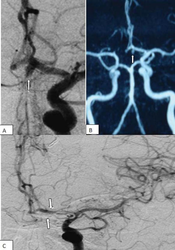 FIGURE 1